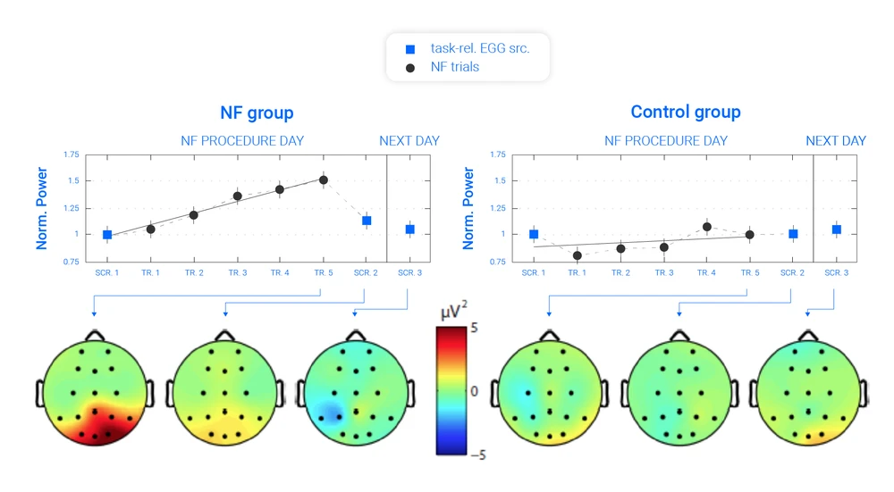 Neuroplastic Changes in Neurofeedback 2 0