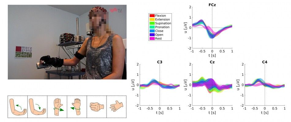 Mujer con lesion medular usando la neuroprotesis en un laboratorio de investigacion