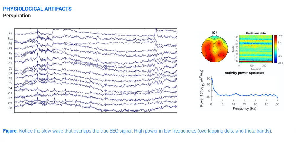 All about EEG Artifacts and filtering tools | Bitbrain