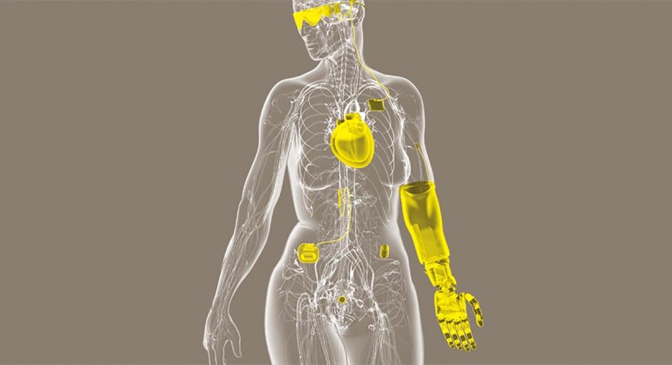 Technological Implants in a person's body