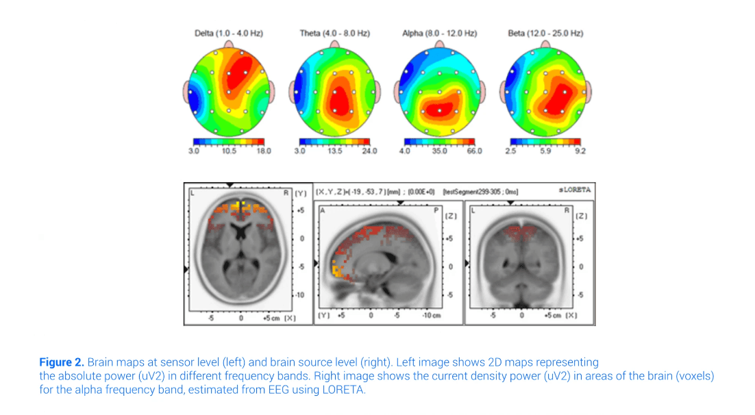 Brain map at sensor level