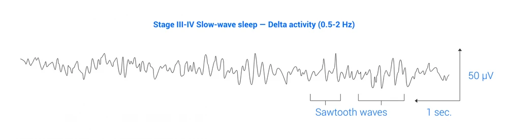 Sleep Eeg Graph 5