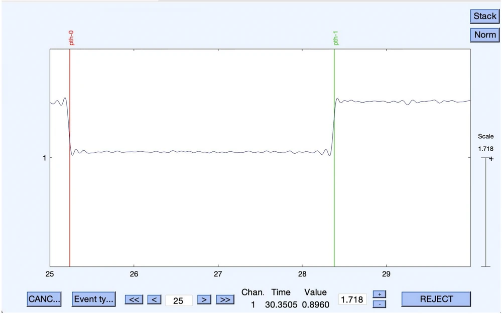 Photodiode Event Transformation for Eeglab