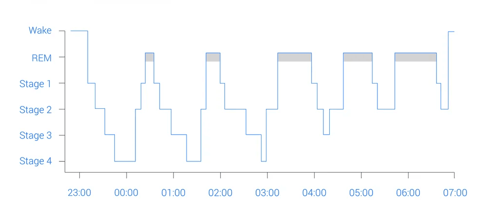 Sleep Eeg Graph