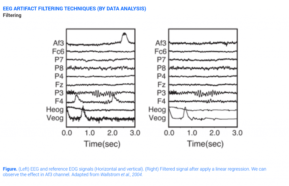 Eeg Artifacts Filtering Technique Filtering