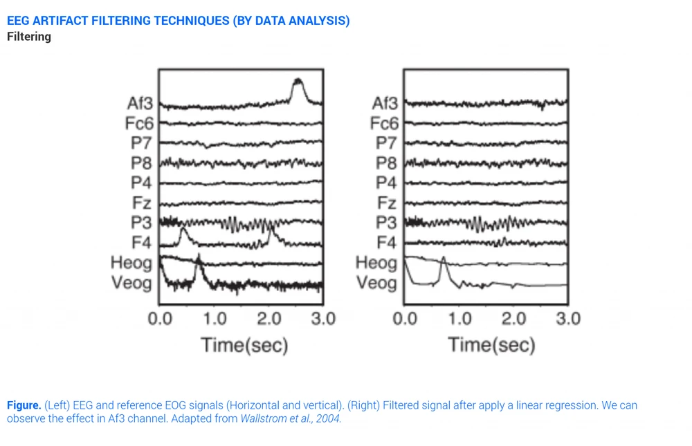 Eeg Artifacts Filtering Technique Filtering