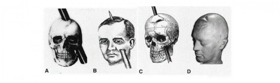 Phineas Gage Emociones Razon 1