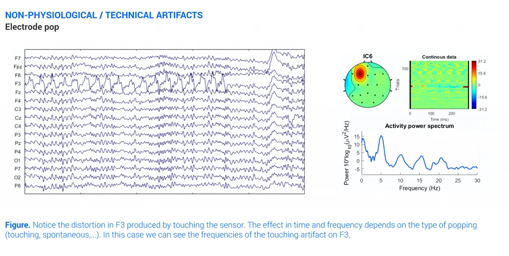 All about EEG Artifacts and filtering tools | Bitbrain