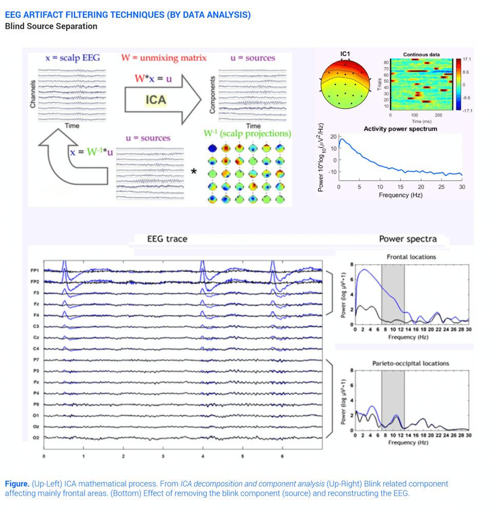 Blind Source Separation Eeg Filtering Technique for Artifacts