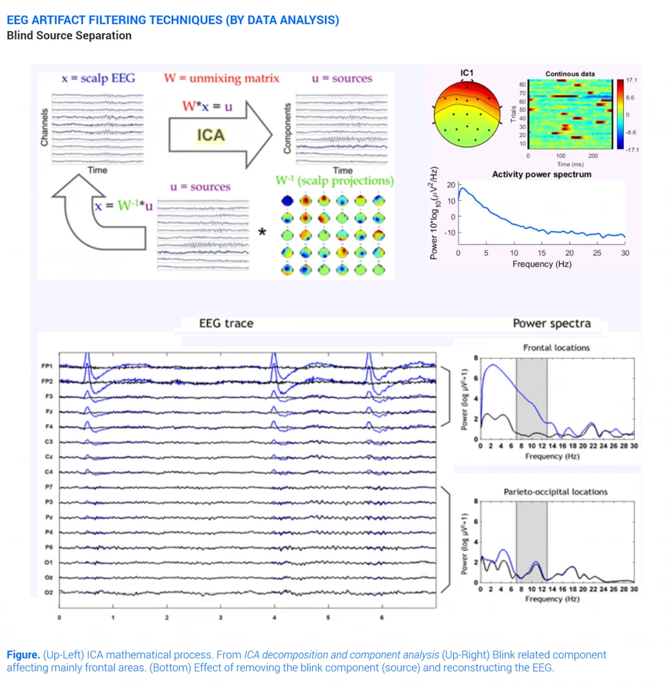 Blind Source Separation Eeg Filtering Technique for Artifacts