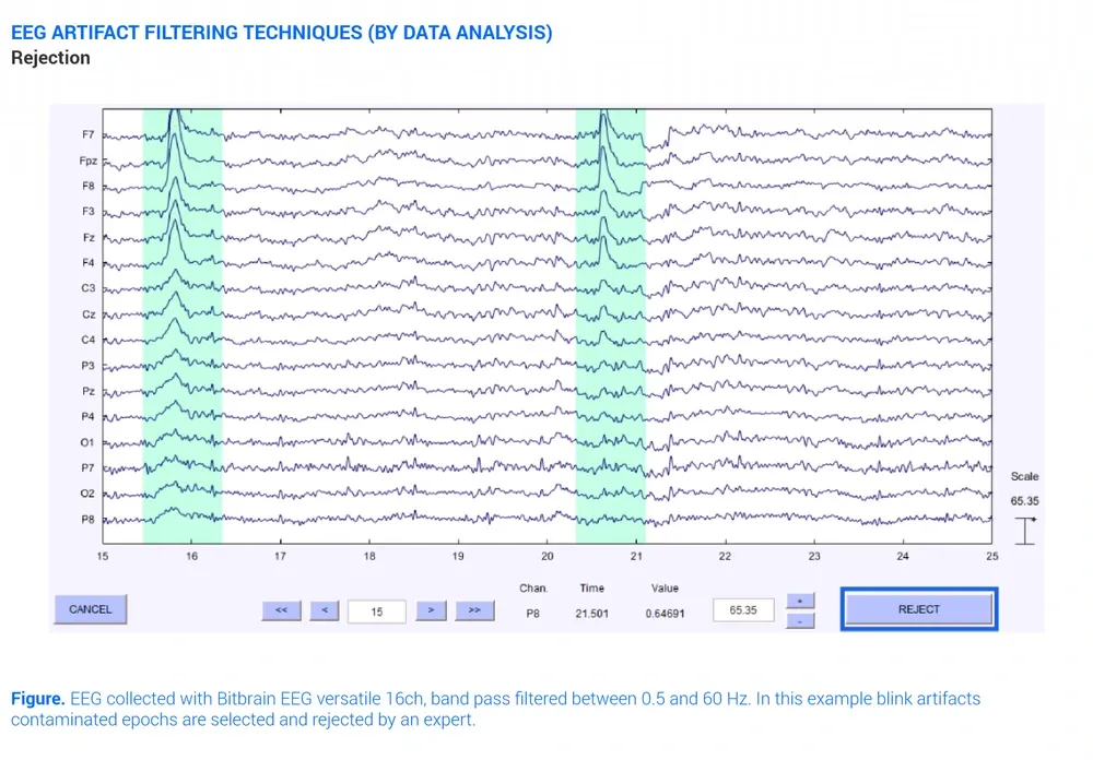 Eeg Artifacts Filtering Technique Rejection