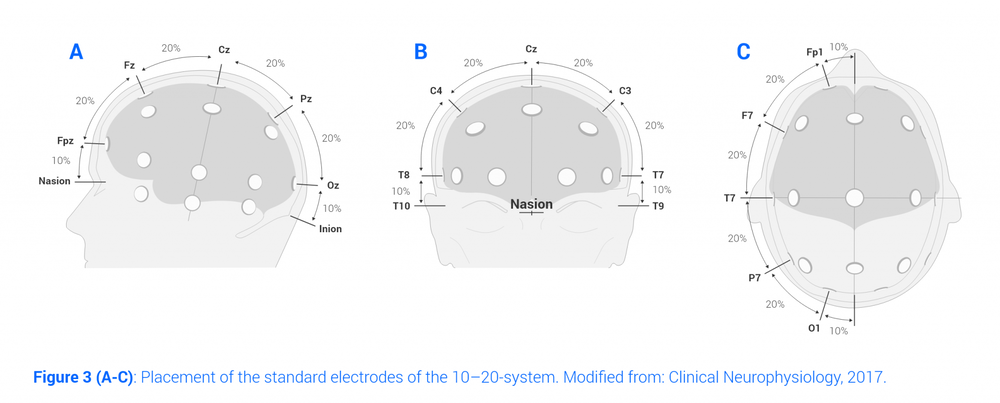 10 20 Eeg System