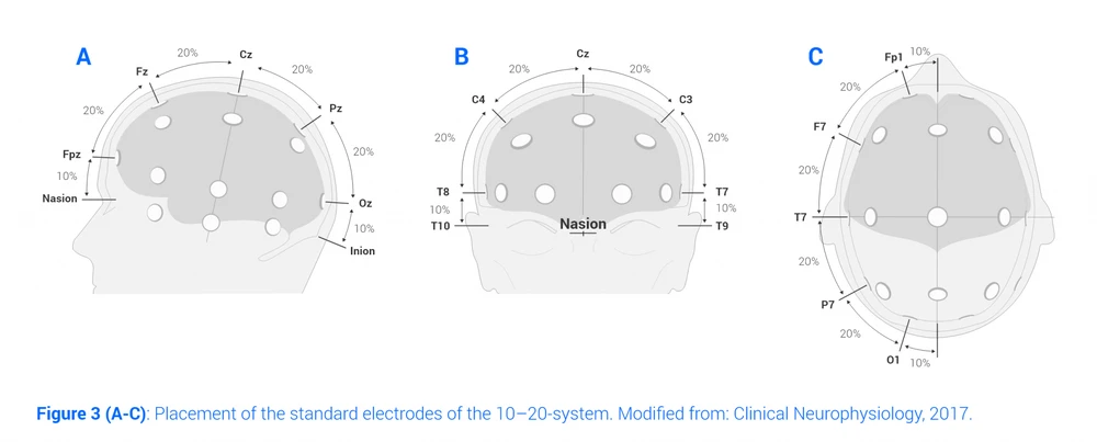 eeg cap 10 20 system