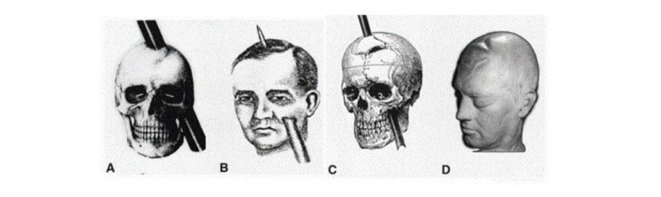 Imagen del accidente de Phineas Gage que ayudó a saber que el lóbulo frontal está relacionado con las emociones y con el razonamiento