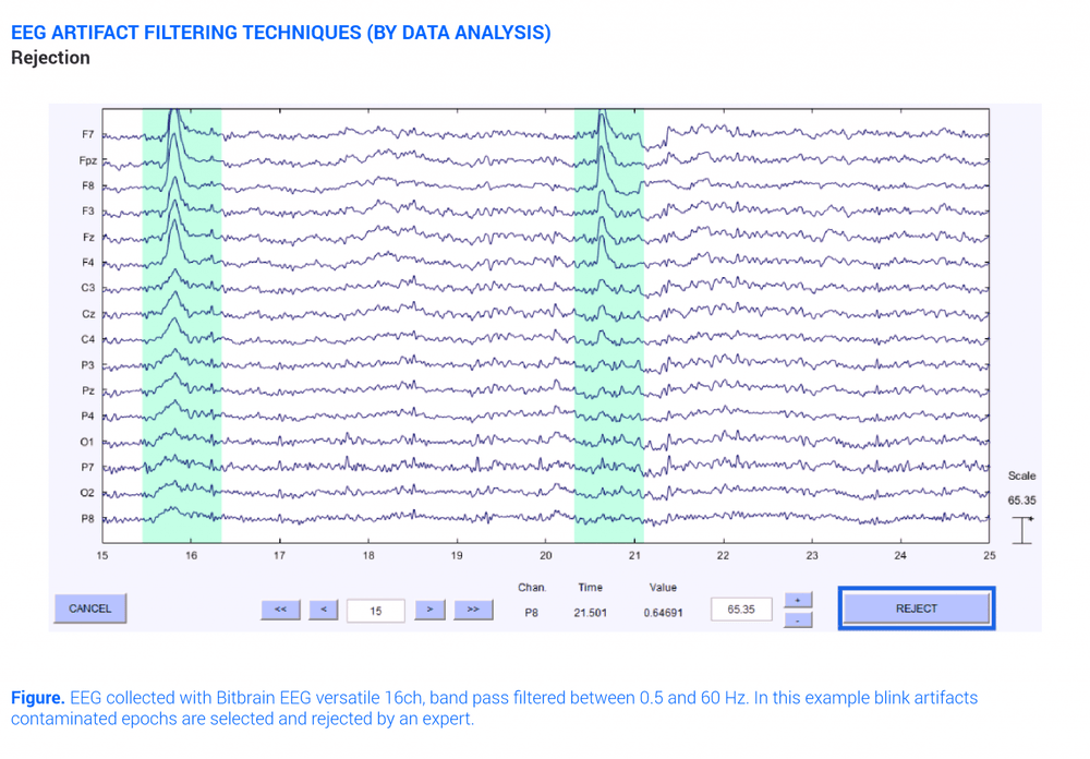 Eeg Artifacts Filtering Technique Rejection