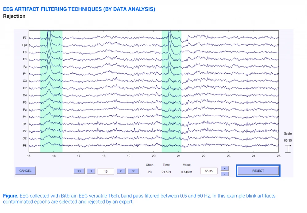 Eeg Artifacts Filtering Technique Rejection