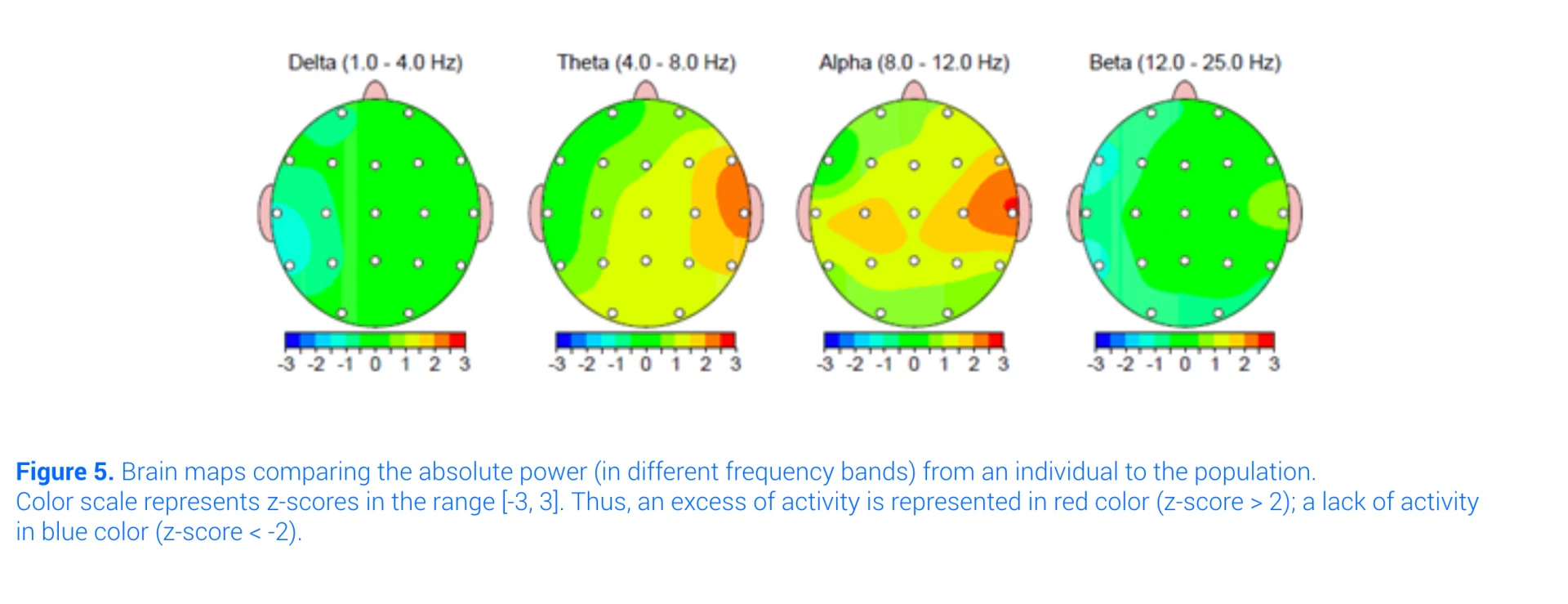 QEEG Dimensional Brain Maps