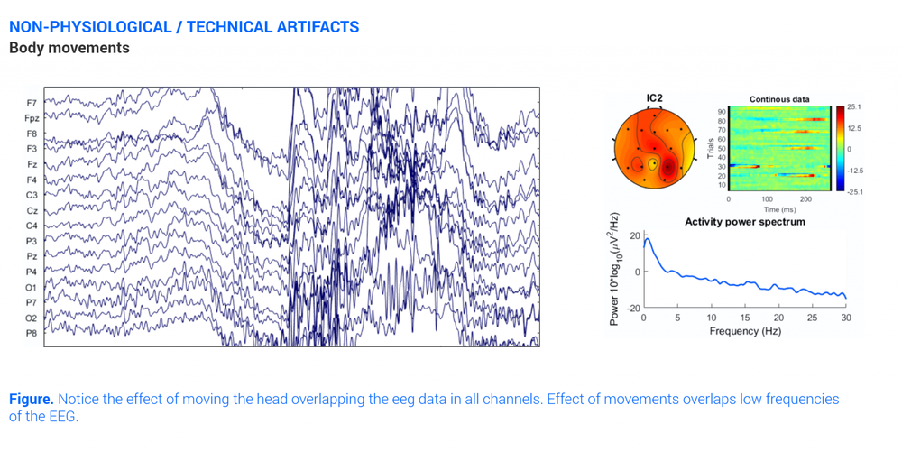 All about EEG Artifacts and filtering tools Bitbrain