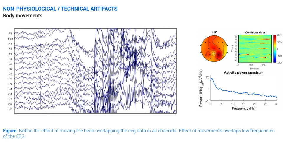 Eeg Artifact Body Movements