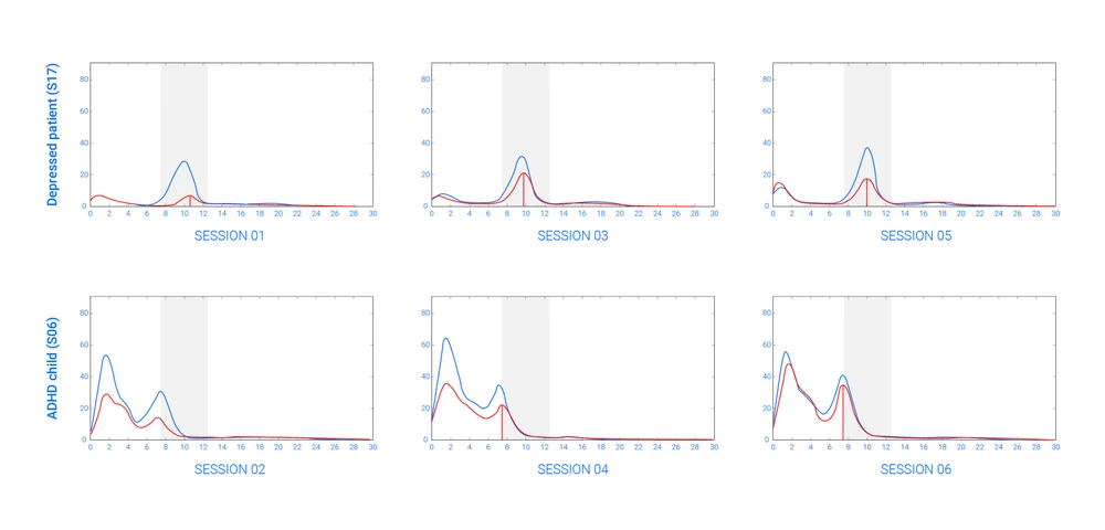 Intra Subject Variability in Eeg Power Spectra