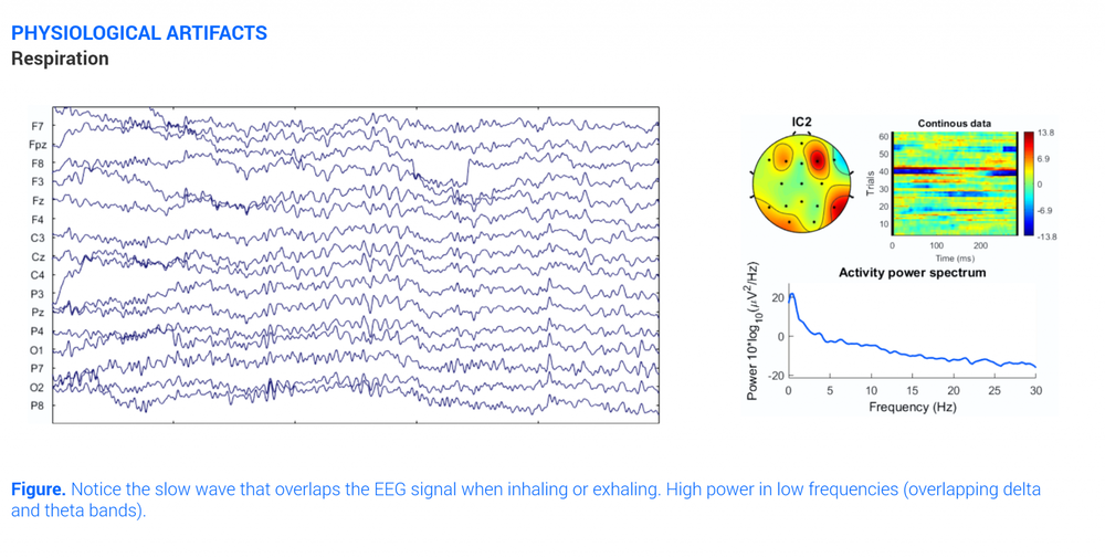 All about EEG Artifacts and filtering tools | Bitbrain