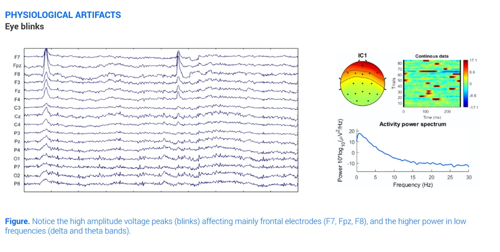 All about EEG Artifacts and filtering tools | Bitbrain