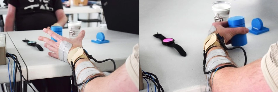 User With Neuroprosthesis Makes Grasping Action Thanks To A Bci Brain-Computer Interface