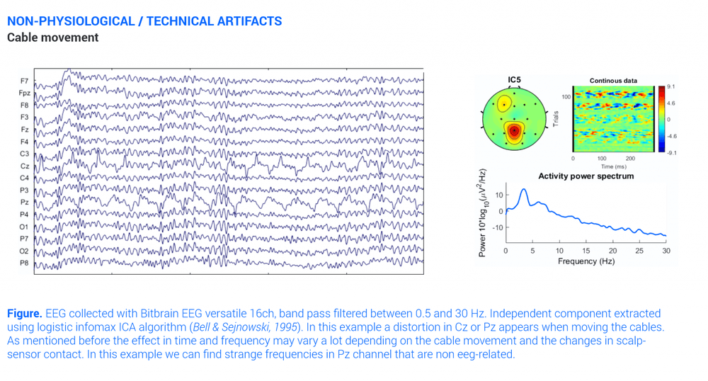 Cable Movement Eeg Artifact