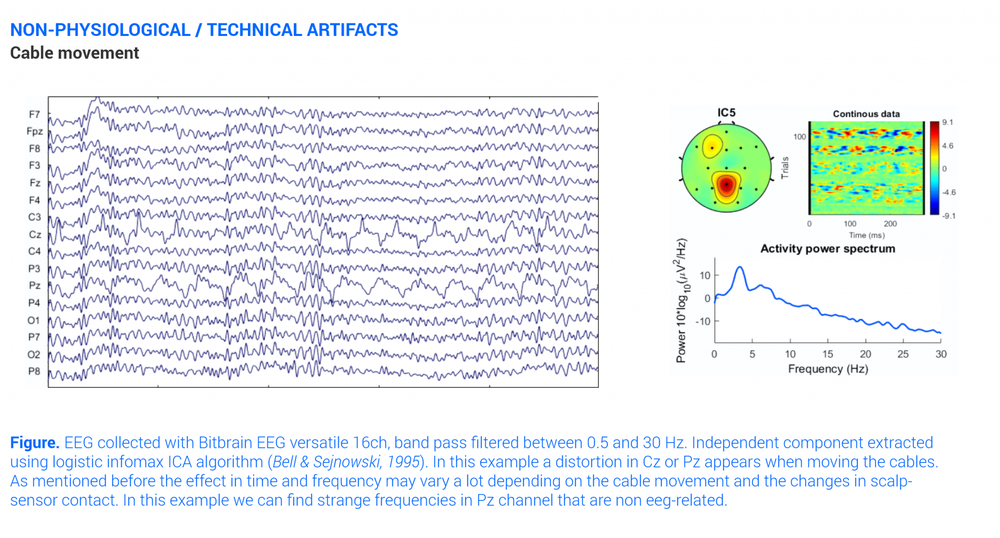 All About Eeg Artifacts And Filtering Tools Bitbrain