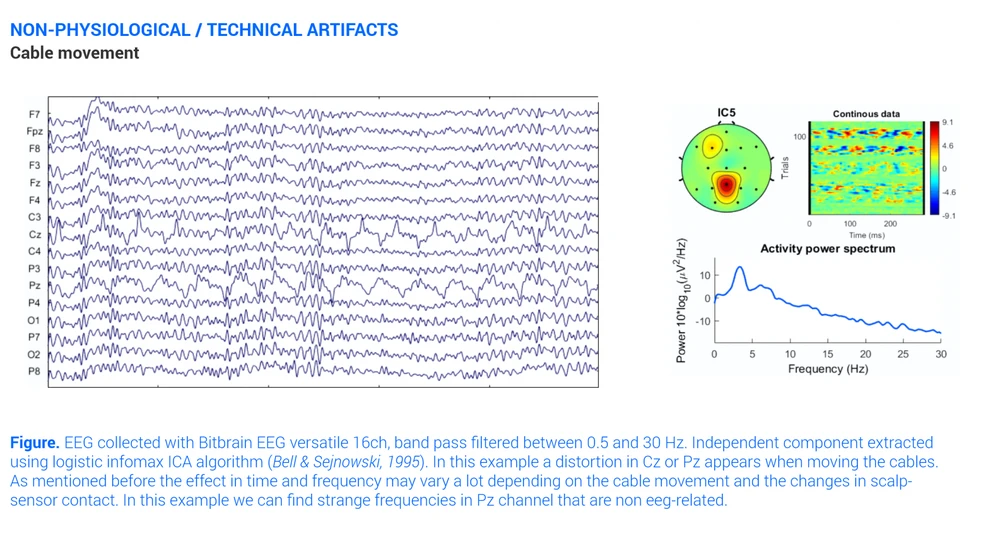 Cable Movement Eeg Artifact