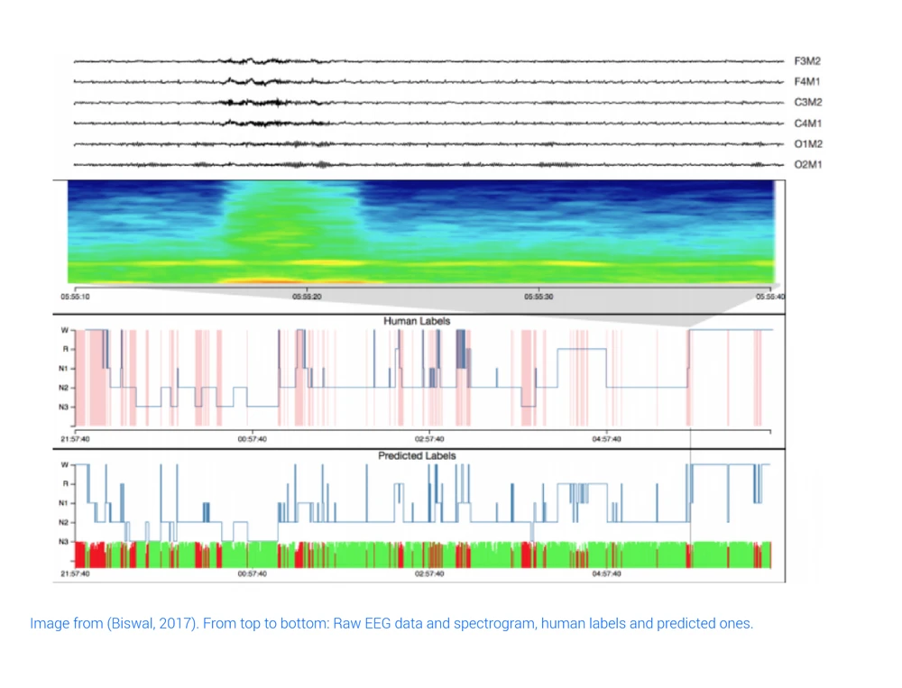 Sleep Eeg Raw Eeg Data and Spectrogram