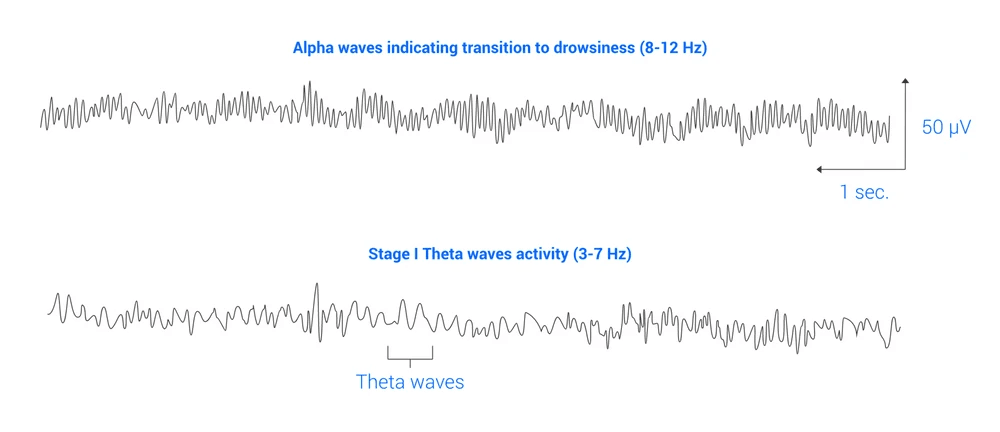 Trazados EEG que muestran ondas alfa de somnolencia y ondas theta de la fase I del sue&ntilde;o.
