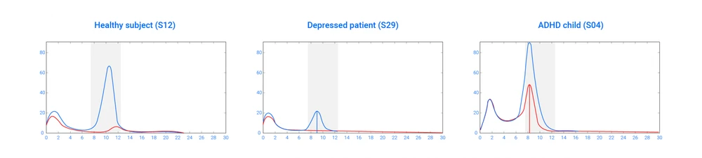 Eeg Power Spectrum