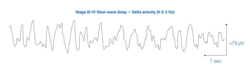 Trazado EEG que muestra la fase III-IV de sue&ntilde;o de ondas lentas con actividad delta.