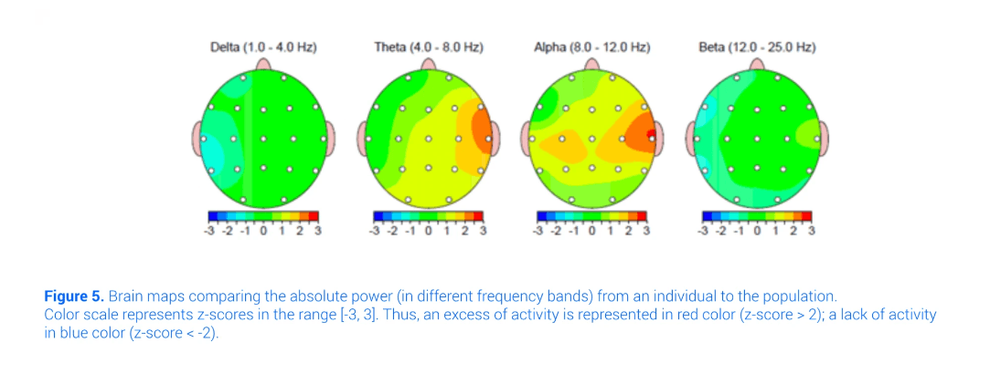 Brain maps comparing the absolute power