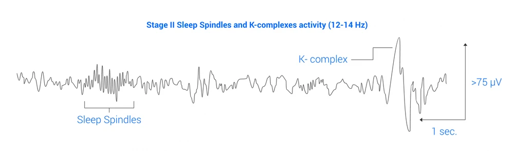 Sleep Eeg Graph 3