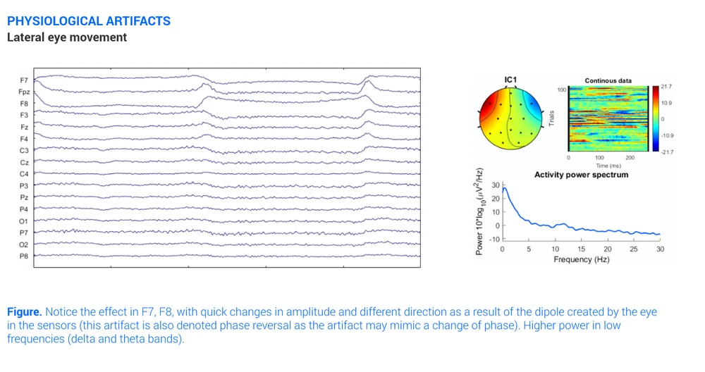 All about EEG Artifacts and filtering tools | Bitbrain