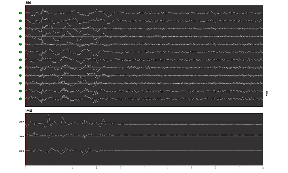 Eeg Signal and Imu